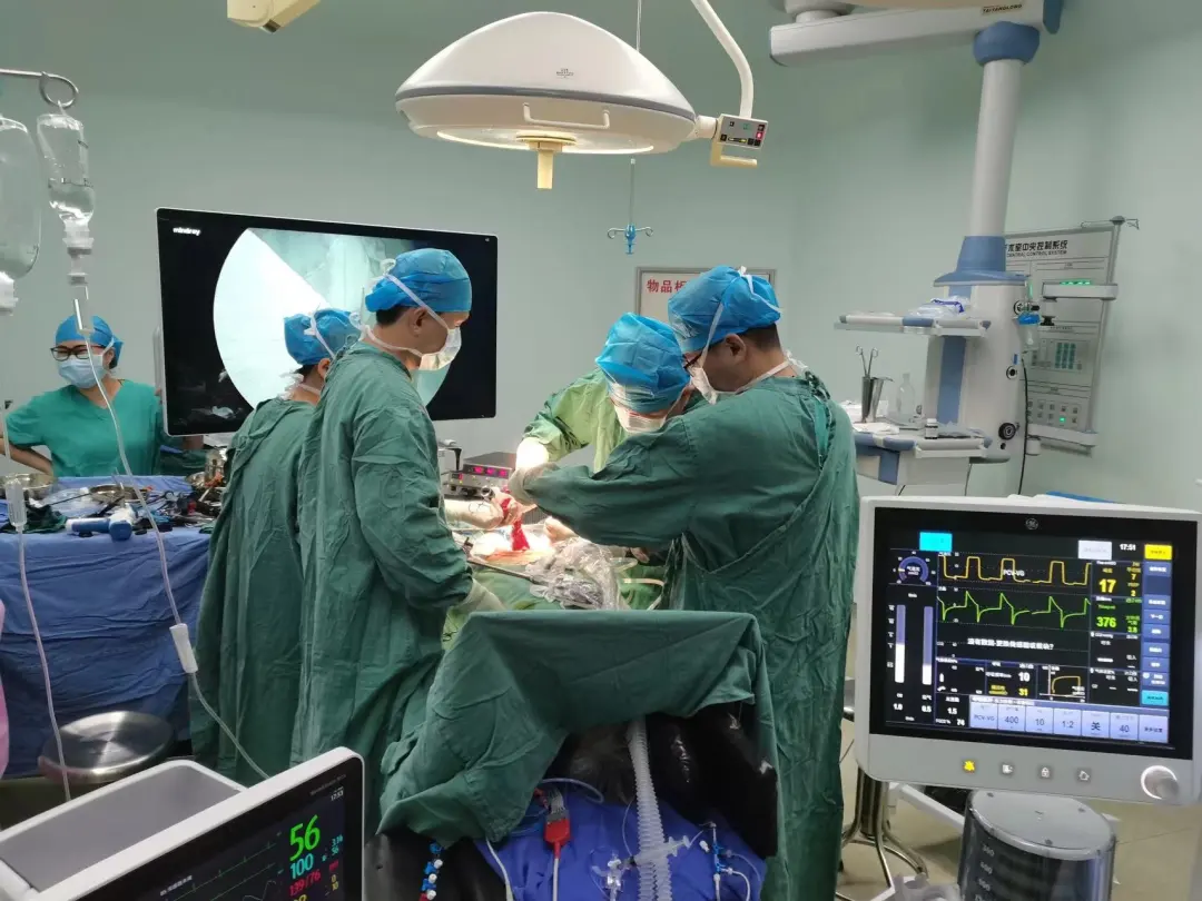 【技术聚焦】省医院托管助力，建立紧密型科室专科联盟，我院成功完成高难度腹腔镜结直肠癌根治术
